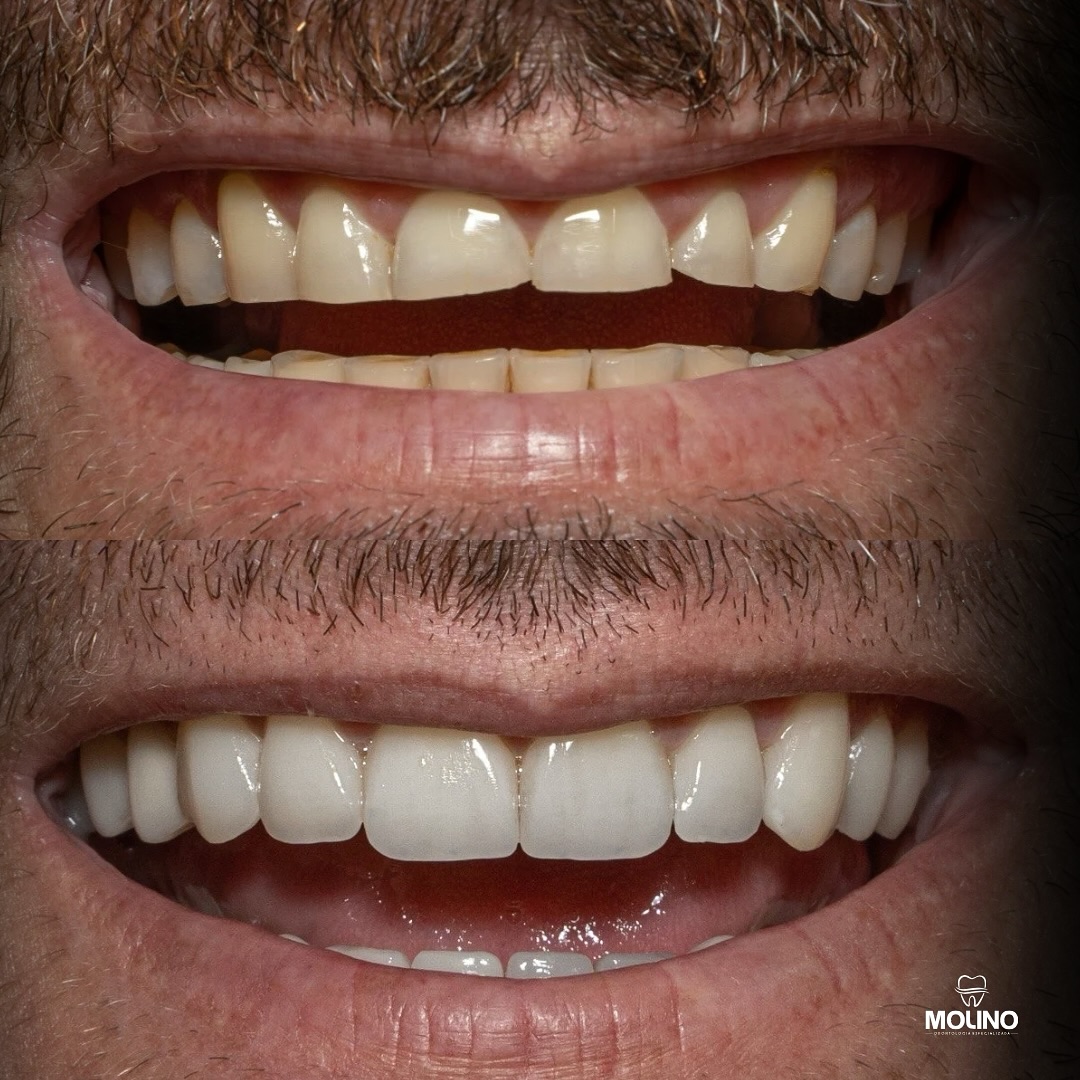 455078085_18269218123244938_2828733104064474995_n