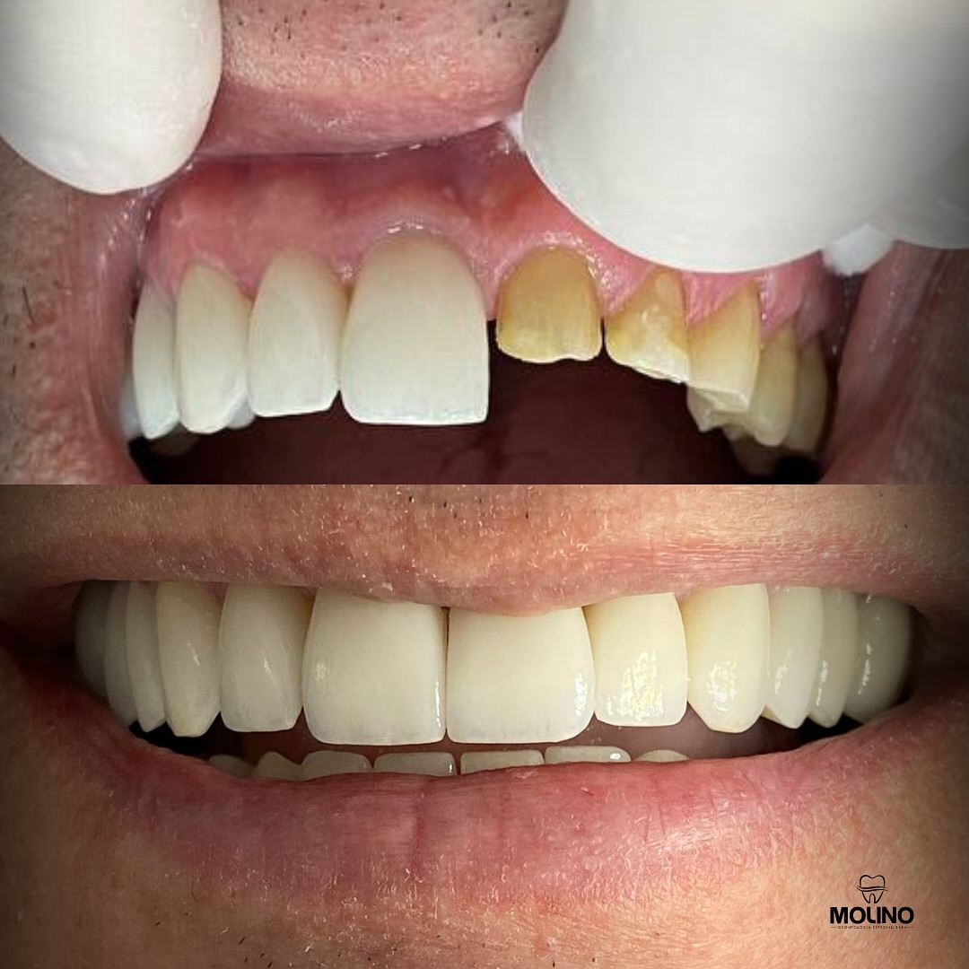 456839847_18270957946244938_8028204906447986444_n