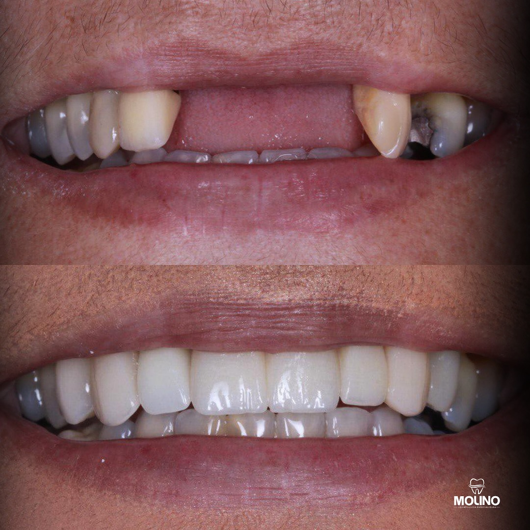 464178858_18278254246244938_7057037145549604859_n